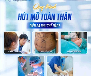 Quy trình hút mỡ toàn thân diễn ra như thế nào?