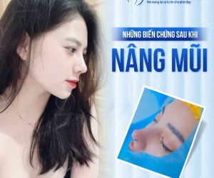 Những biến chứng có thể xảy ra sau khi nâng mũi