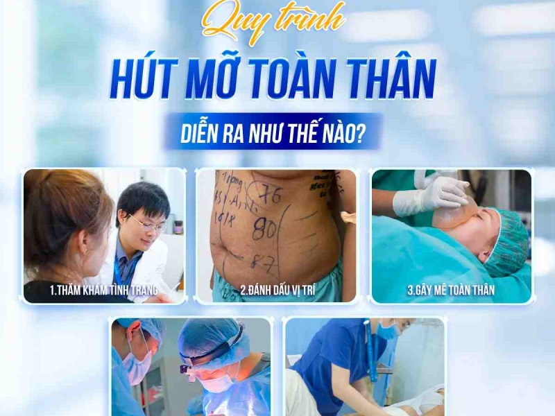 Quy trình hút mỡ toàn thân diễn ra như thế nào?